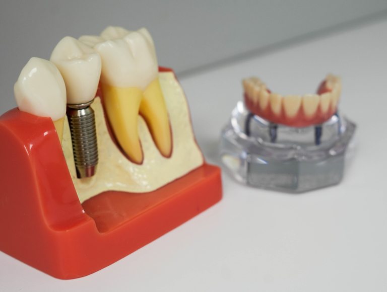 A Comprehensive Solution for Your Smile